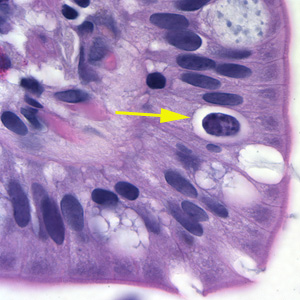 Cystoisospora belli